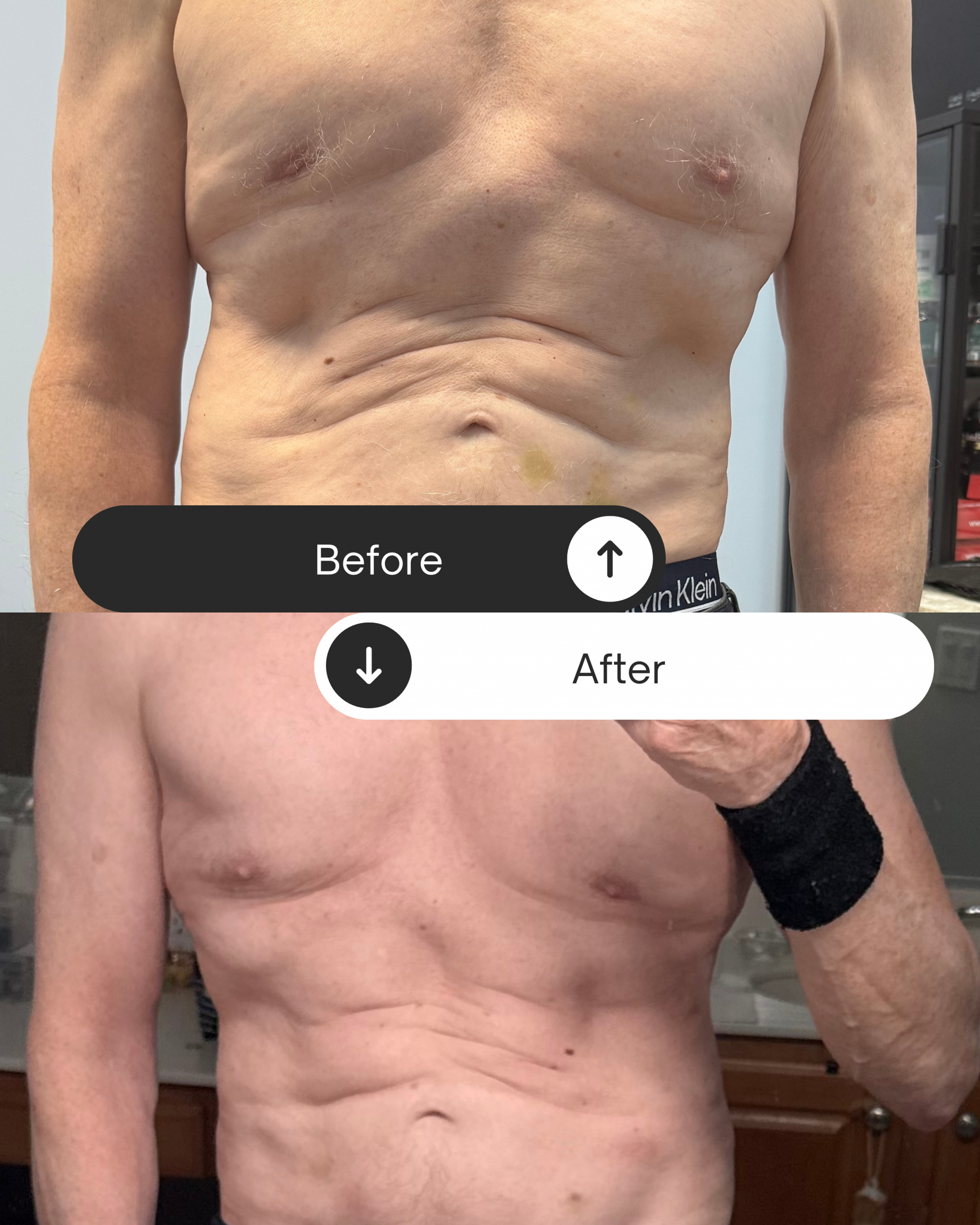 Looking for a Trusted Weight Loss Clinic in Sarasota, Florida? Start at Rapid No Surgery Fat Loss