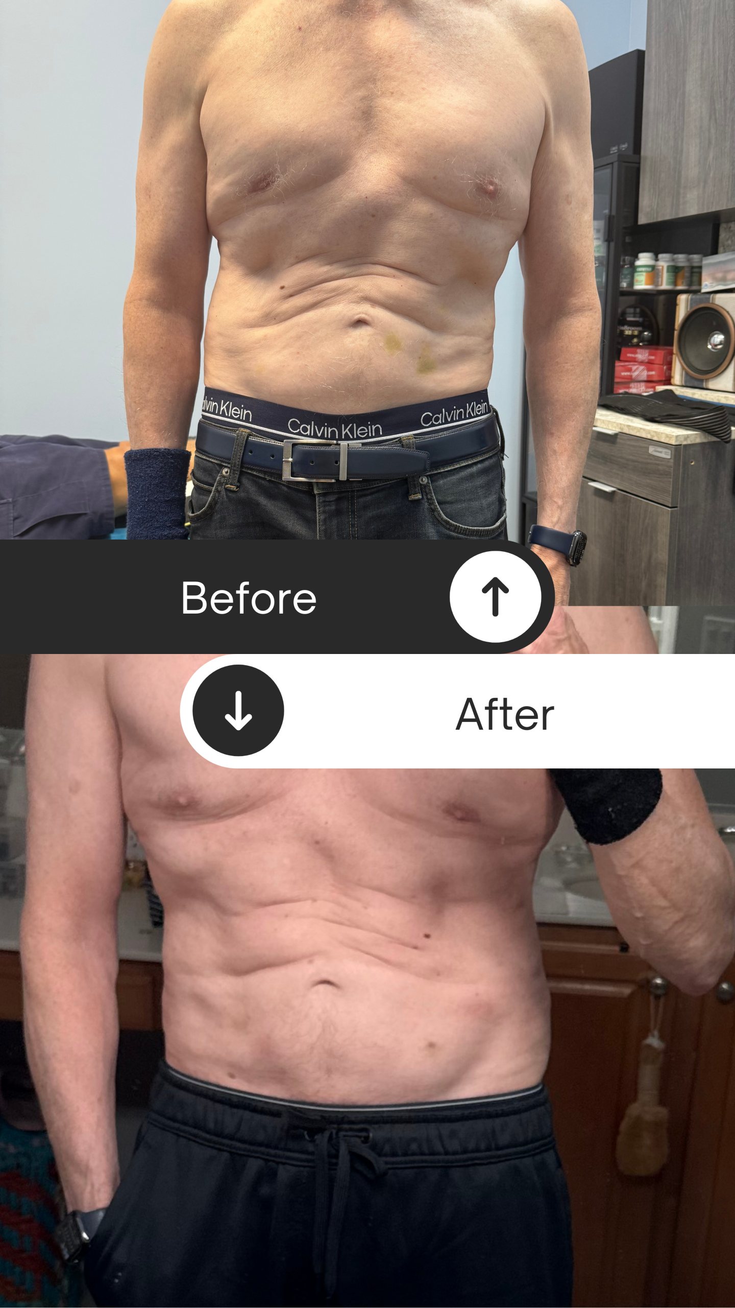 Discover the Future of Fat Loss: Why GLP-3 Therapy at Rapid No Surgery Fat Loss Is Changing Lives